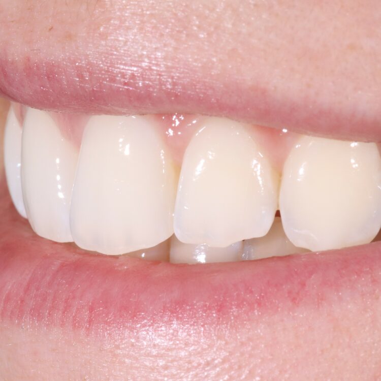 Schöne Zähne