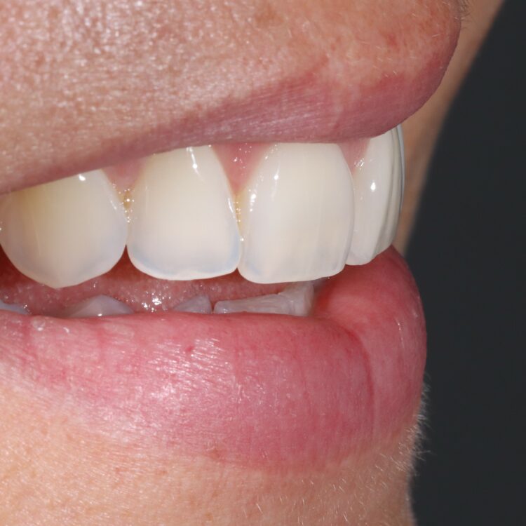 Nahaufnahme schöne weiße Zähne